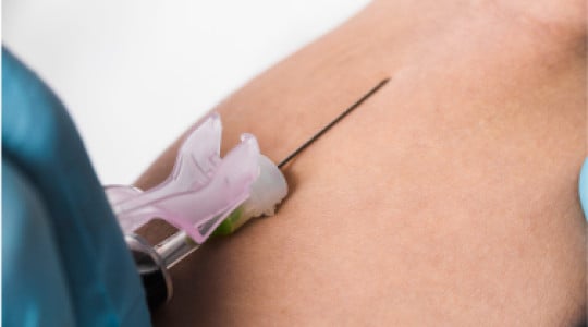 Plasma rico en plaquetas (PRP)