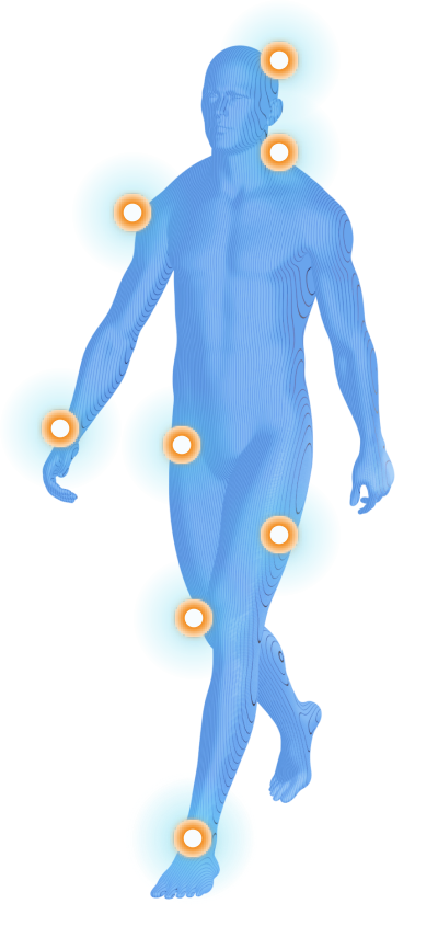 Figura del cuerpo humano con las zonas de dolor destacadas