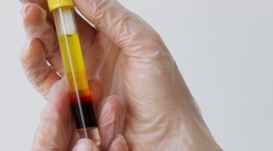 Suero Rico en Factores (SRF)